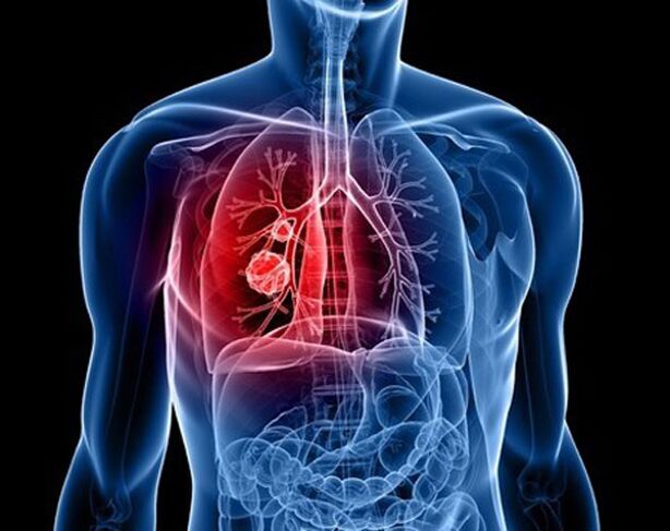 Parasitoak biriketan