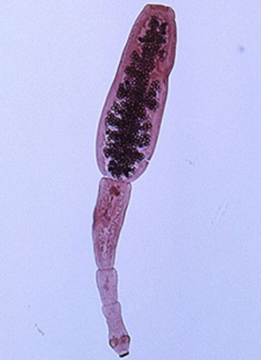 Echinococcus giza gorputzetik
