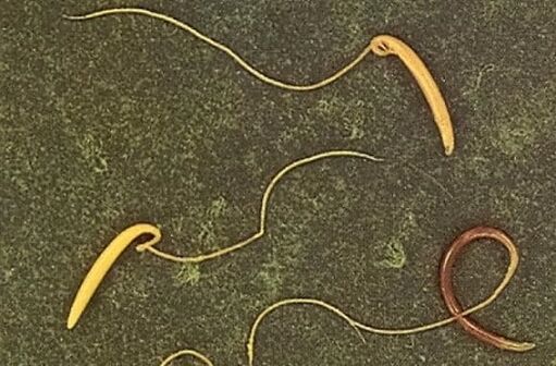 giza gorputzeko zurrumurrua