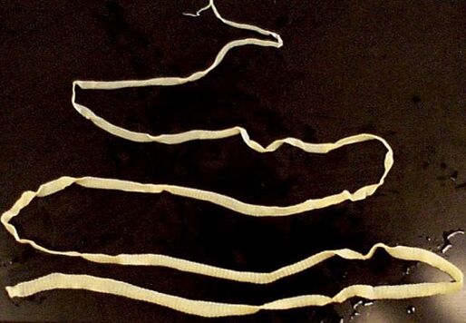 giza gorputzetik tenia zabala