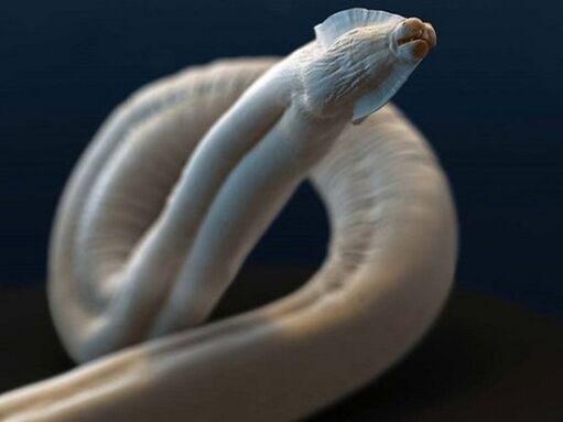 giza gorputzetik toxokara