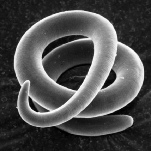 zizare parasitoa trichinella gizakietan