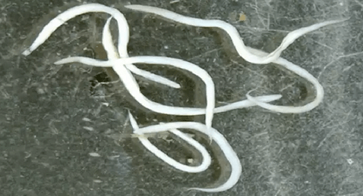 zizareak giza gorputzean