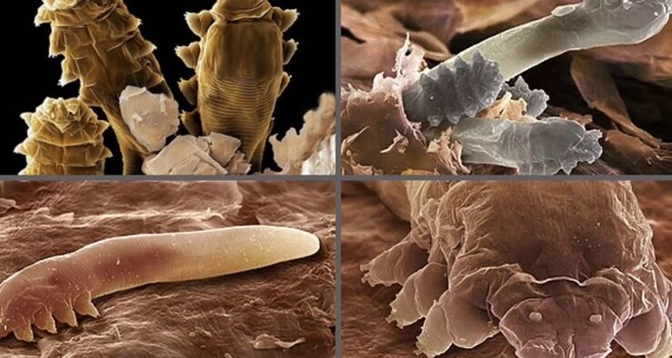 giza azaleko parasito motak