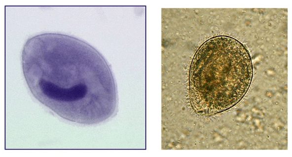 Balantidia ziliatuak, heste lodian parasitoa