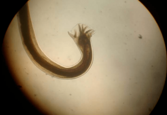 Parasitoa mikroskopioan